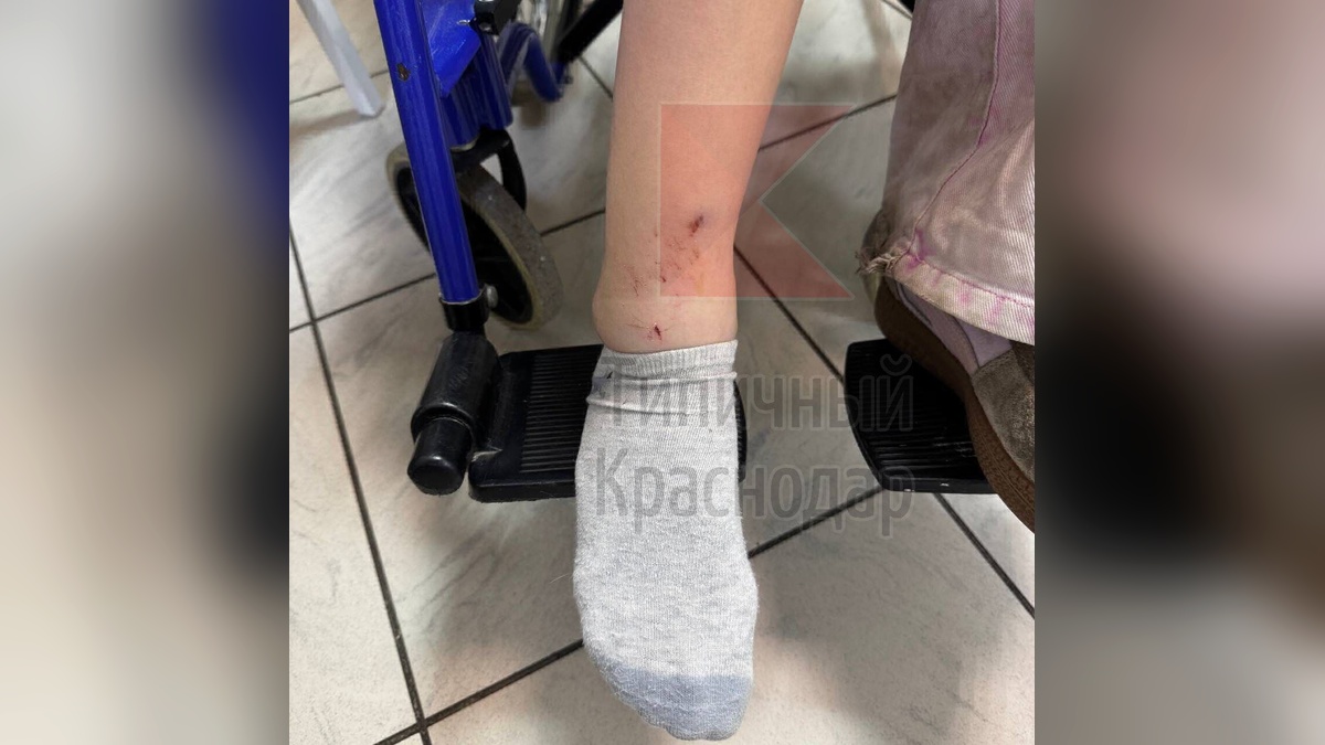 СК возбудил дело после падения качели на ногу школьницы в Краснодаре