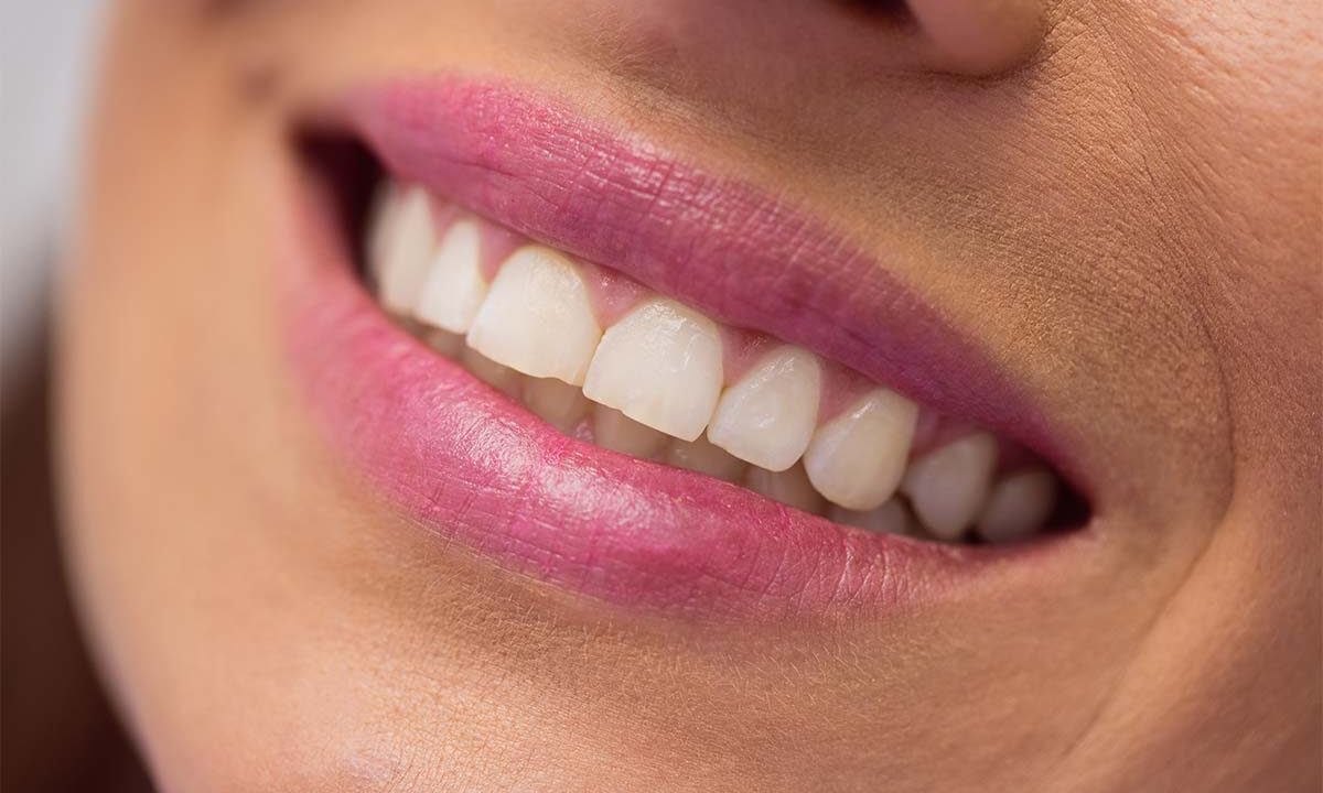 Что такое ночной бруксизм и чем он опасен?