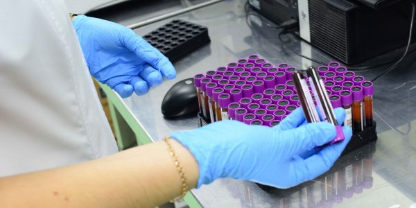 Пункт тестирования на ВИЧ-инфекцию откроют в Екатерининском сквере в Краснодаре